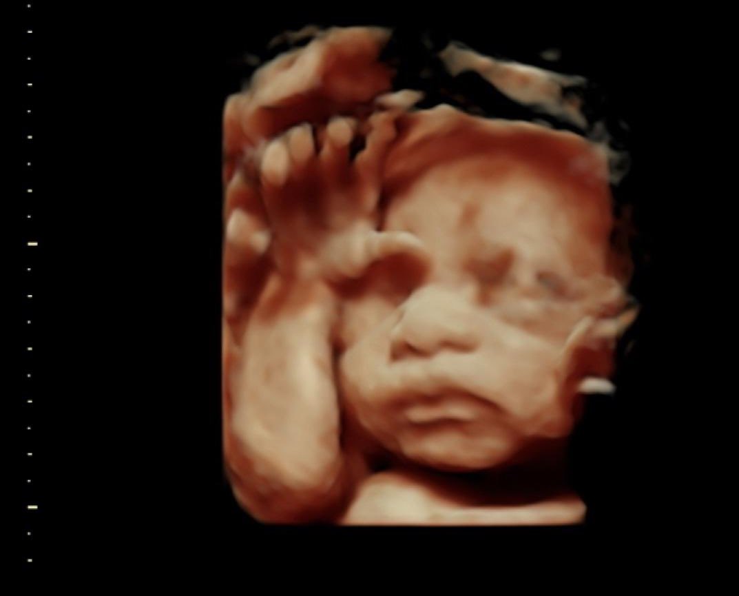 obianuju's tweet image. Can we all agree that it is a horrific evil to kill either of these babies?