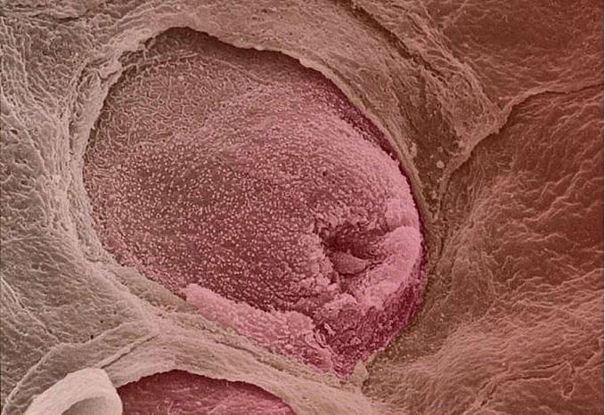CienciaDelCope's tweet photo. Una papila gustativa. 👅📷: ¿? https://t.co/AoB8jPfL8k