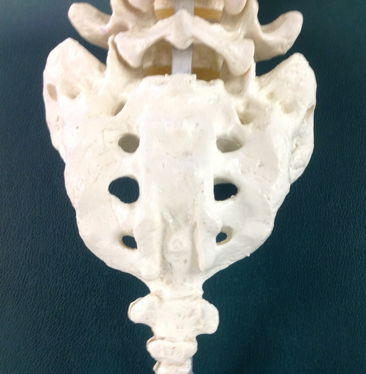 iOrthoApp's tweet photo. Preview of iOrtho+ Upcoming Wednesday Blog - Challenges of SI Testing- Part 1. For prior topics visit: https://t.co/ASdu0Aa278
#dptstudent #athletictraining #orthopedics #physiotherapy #manualtherapy #PT #DPT #SIJ #Lowbackpain #doctorofphysicaltherapystudents #LBP #SIpain https://t.co/4UBXbYsV6a