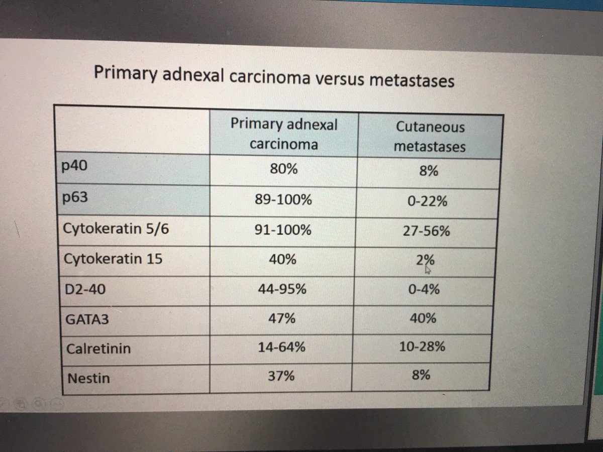 GregHoslerMDPhD's tweet image. Mai Hoang had great info in her #ASDP2020 talk. This slide stood out for me as quite useful as primary v mets is a big deal!!Thank you! #dermpath #pathology