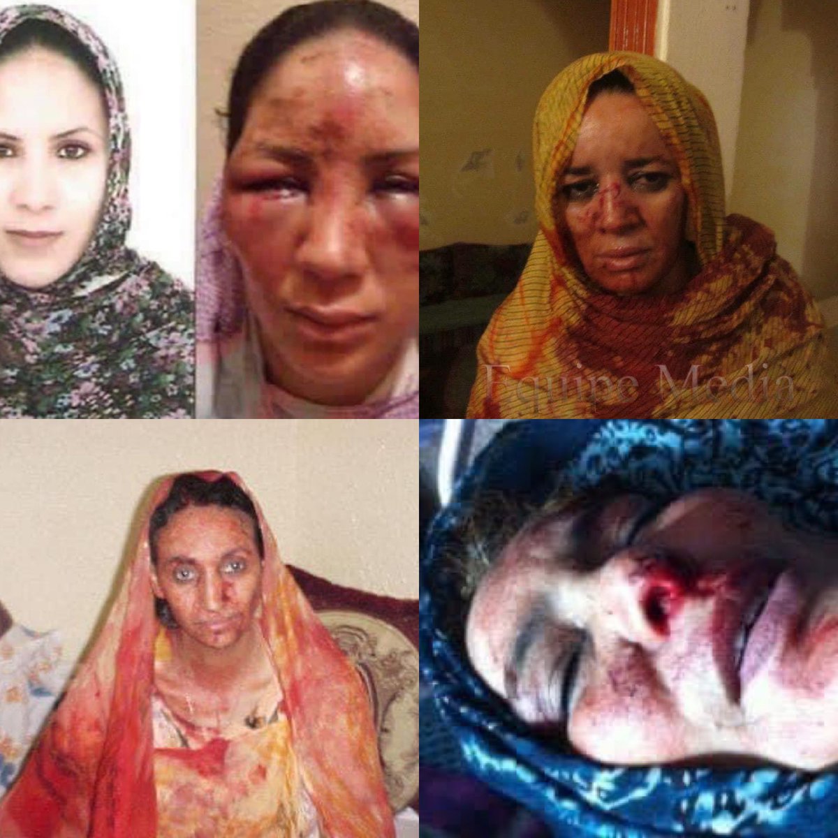 لكي لا نسى جرائم الاحتلال المغربي في حق المدنيين بالصحراء الغربية #FreeWesternSahara