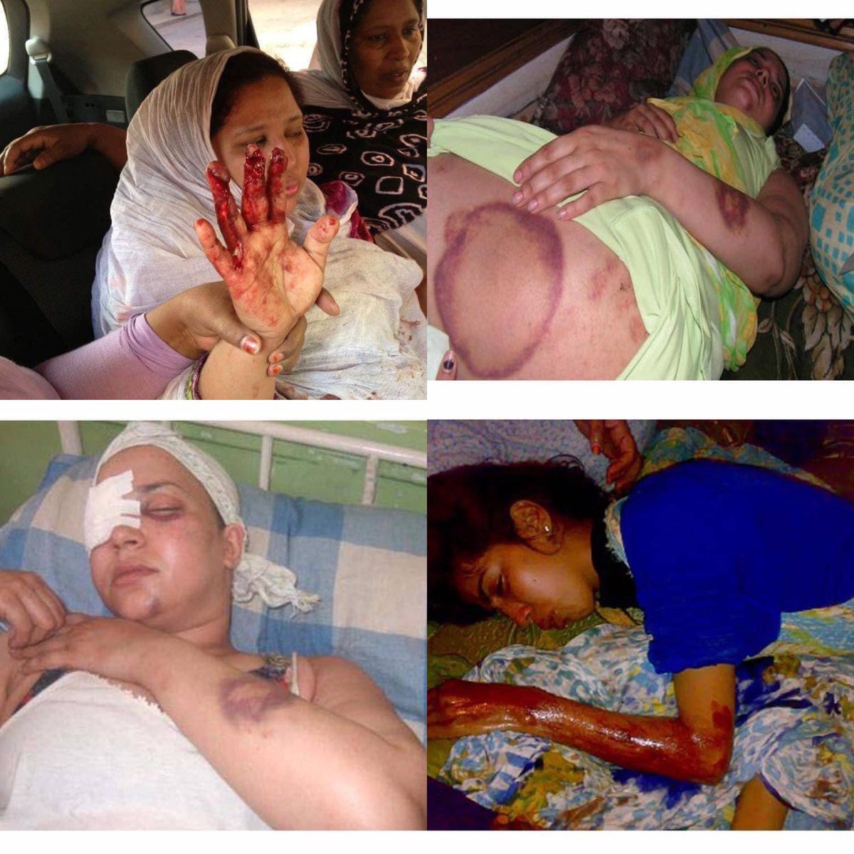 لكي لا نسى جرائم الاحتلال المغربي في حق المدنيين بالصحراء الغربية #FreeWesternSahara