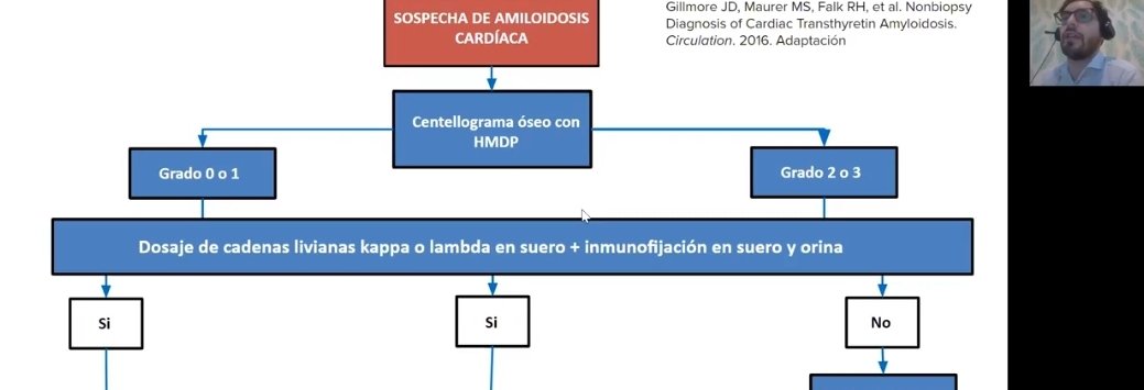 SACnuclear's tweet photo. Congreso #SAC20 ⏰11:20 Viernes
📌"Compromiso Cardiaco en paciente con Amiloidosis" 💯
Dr.Gustavo Daquarti @Daqua
📌"Aporte de la Medicina Nuclear en el Diagnostico" @SACnuclear
@AacNuclear @sac_hit
@TomoResoSac @SAC_54 #cardionuclear #Amiloidosis @FundFavaloro @SIAC_MCP https://t.co/HGUf0tle6t