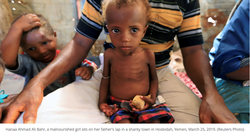 178kakapo's tweet photo. .@UN
U repeat the "warning", anytime, anywhere.
But, ur "warning" isn't medicine or food ◢◤
Therefore, u cannot save ppl in distress now‼️
#SaveSufferingChildren
#Yemen
❝
UN warns of looming famine as Yemen faces countdown to catastrophe
https://t.co/AZ3Vjny81v
NOV 12, 2020 https://t.co/P4Djlv6l7Z