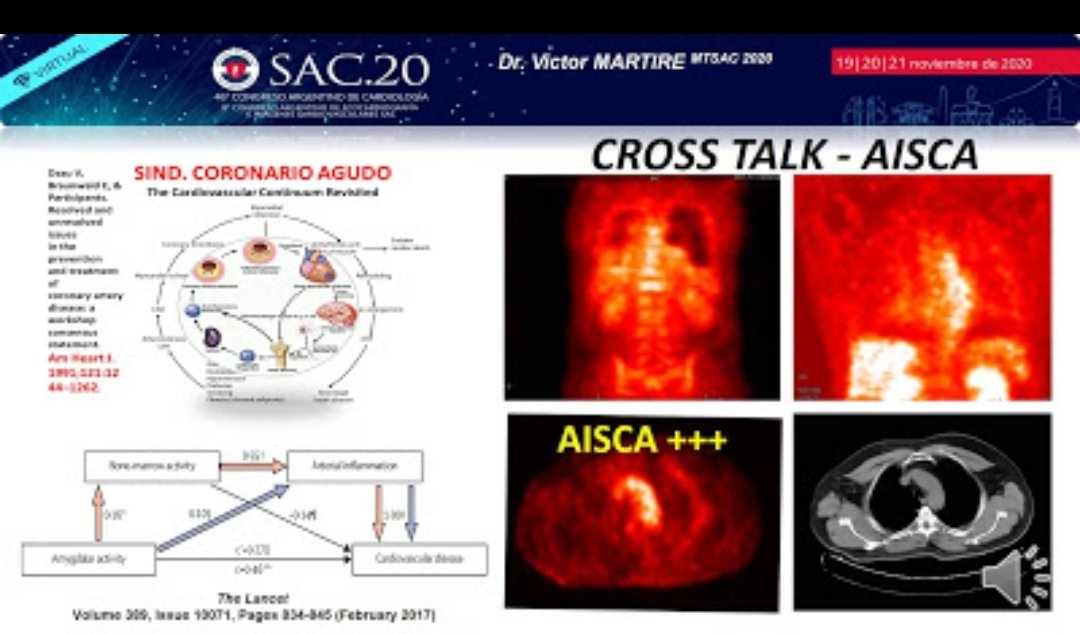 SACnuclear's tweet photo. Congreso #SAC20 ⏰14:05 viernes 20/11 🔊 No te lo pierdas ➡️Mesa: 📌 "Estrategias y metas
de Prevención CV en el paciente Vascular" 📌"¿Es posible identificar placas vulnerables con PET/TC?
🎤 dr Victor Martire y oradores 💯 @CARDIONUCLEAR 💯 @sac_hit @SAC_54
@AacNuclear https://t.co/1JO7rbnES8