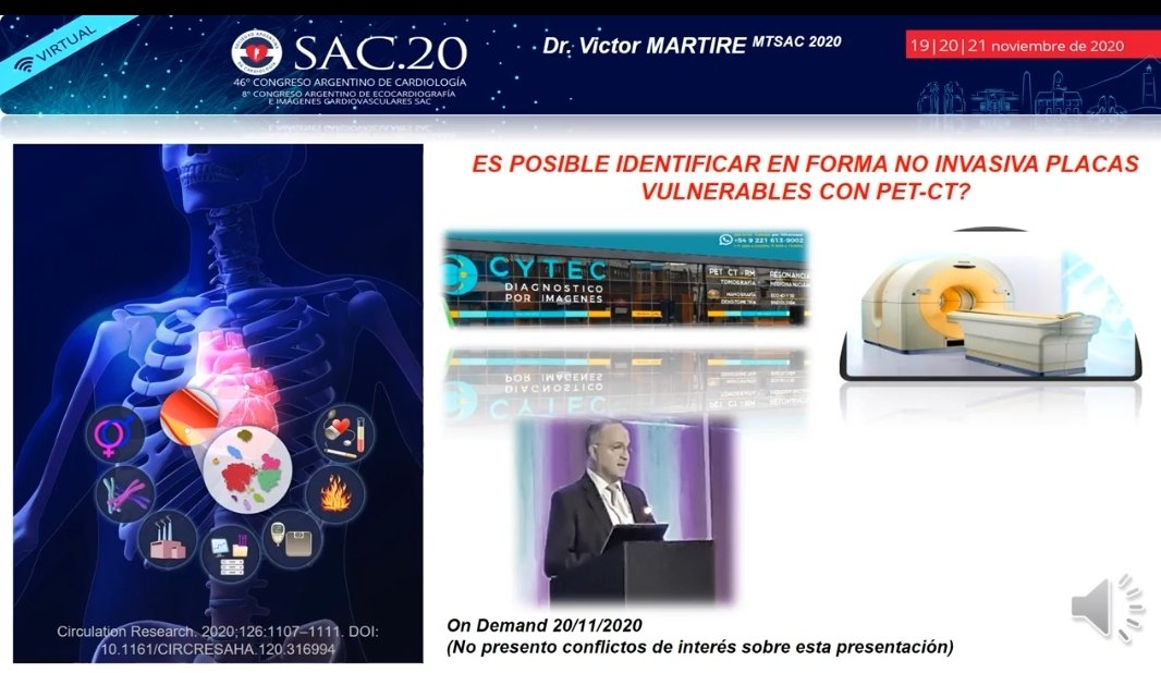 SACnuclear's tweet photo. Congreso #SAC20 ⏰14:05 viernes 20/11 🔊 No te lo pierdas ➡️Mesa: 📌 "Estrategias y metas
de Prevención CV en el paciente Vascular" 📌"¿Es posible identificar placas vulnerables con PET/TC?
🎤 dr Victor Martire y oradores 💯 @CARDIONUCLEAR 💯 @sac_hit @SAC_54
@AacNuclear https://t.co/1JO7rbnES8