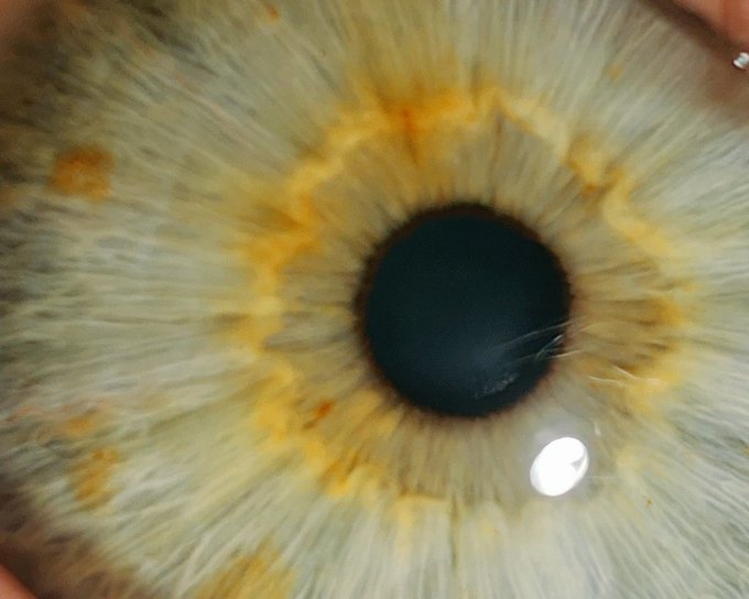 so this weeke d was so rough it caused my eyes to be messed up I had no idea this was even possible I