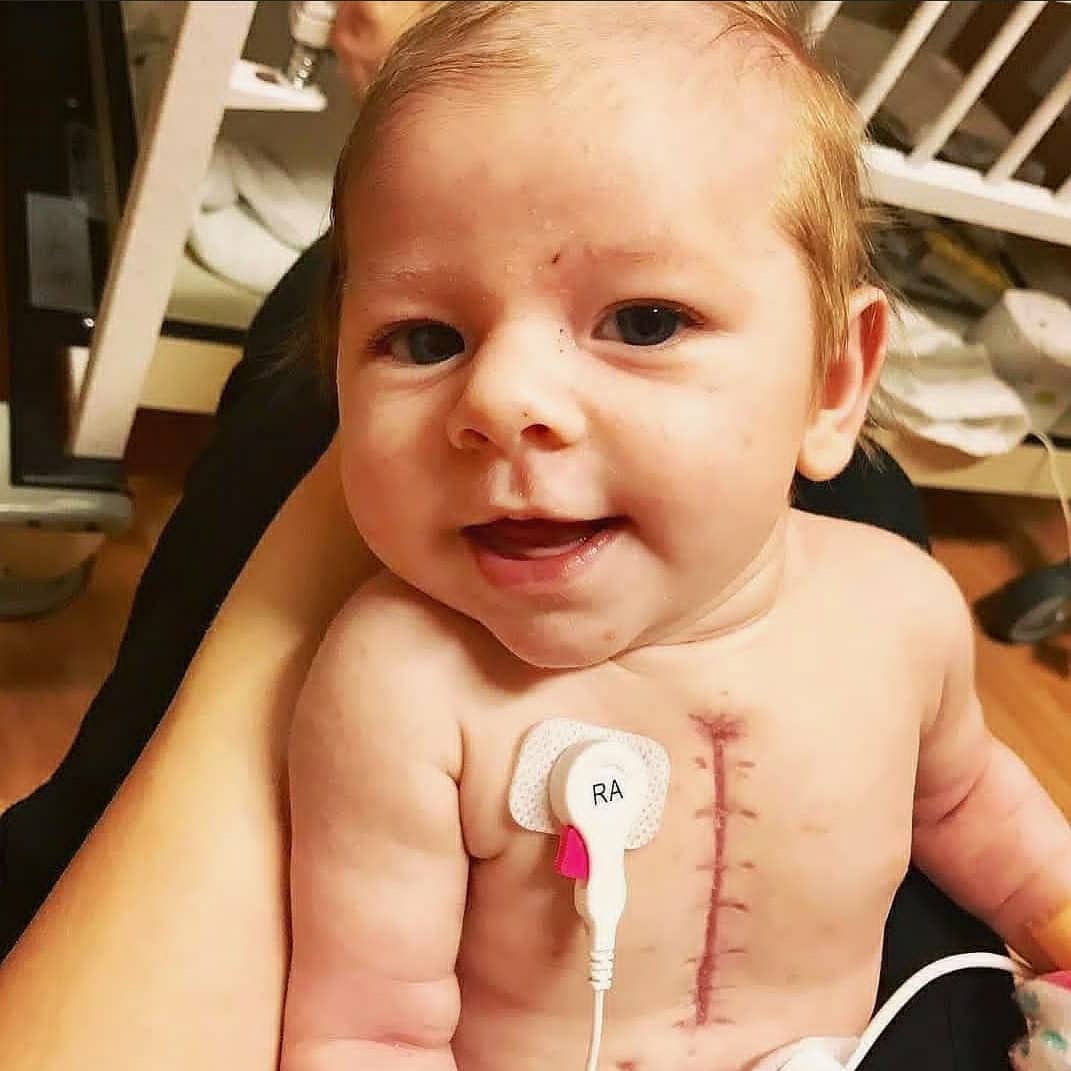Little Zola was born with a congenital heart defect called hypoplastic left heart syndrome

The left side of the heart is critically underdeveloped thereby affecting the normal blood flow, so that less oxygen-rich blood is pumped to the body...