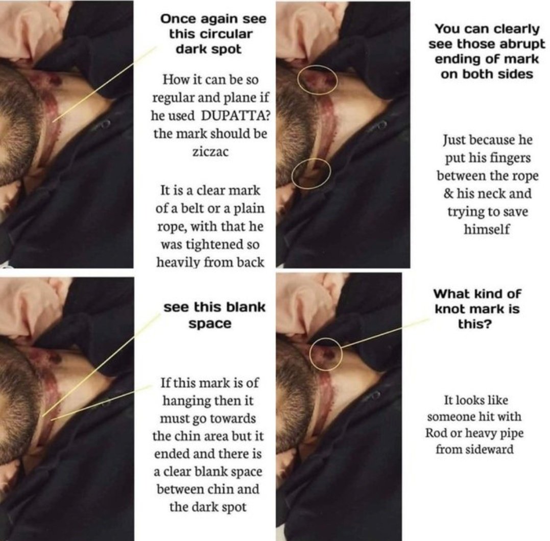 RuhiZ9880's tweet image. How Brutally they Killed Our Sushant..

#SushantAsking4Justice 
@PMOIndia 
@HMOIndia 
@AmitShah 
@ips_nupurprasad 
@Anilyadav_IPS