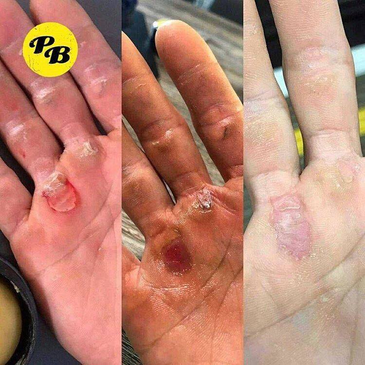 TeamProBalm's tweet photo. @MorganaFry Morgana! We've got a product that will sort those hands right out 😎

Try ProBalm today: https://t.co/ETIetHSwRt https://t.co/AcMLvW1IKF