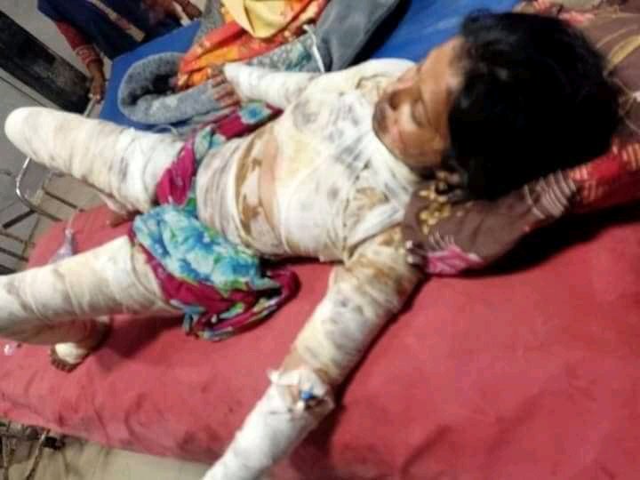I_am_saddam4494's tweet photo. #Gulnaz in Vaishali was burnt alive by #Darinde Satish Yadav and his companions 17 days ago just because he refused to get married, that sister died last night at 12 o'clock and he is roaming free The girl is from a very poor family,
#SatishKoFansiDo #JusticeForGulnaz https://t.co/yQCqvXegbx