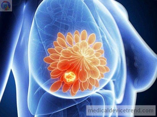HyperthermieAMS's tweet photo. Lees mee over de ervaring van #hyperthermie bij #borstkanker https://t.co/gtZ3V0ymNB https://t.co/h1bVLO2TZQ