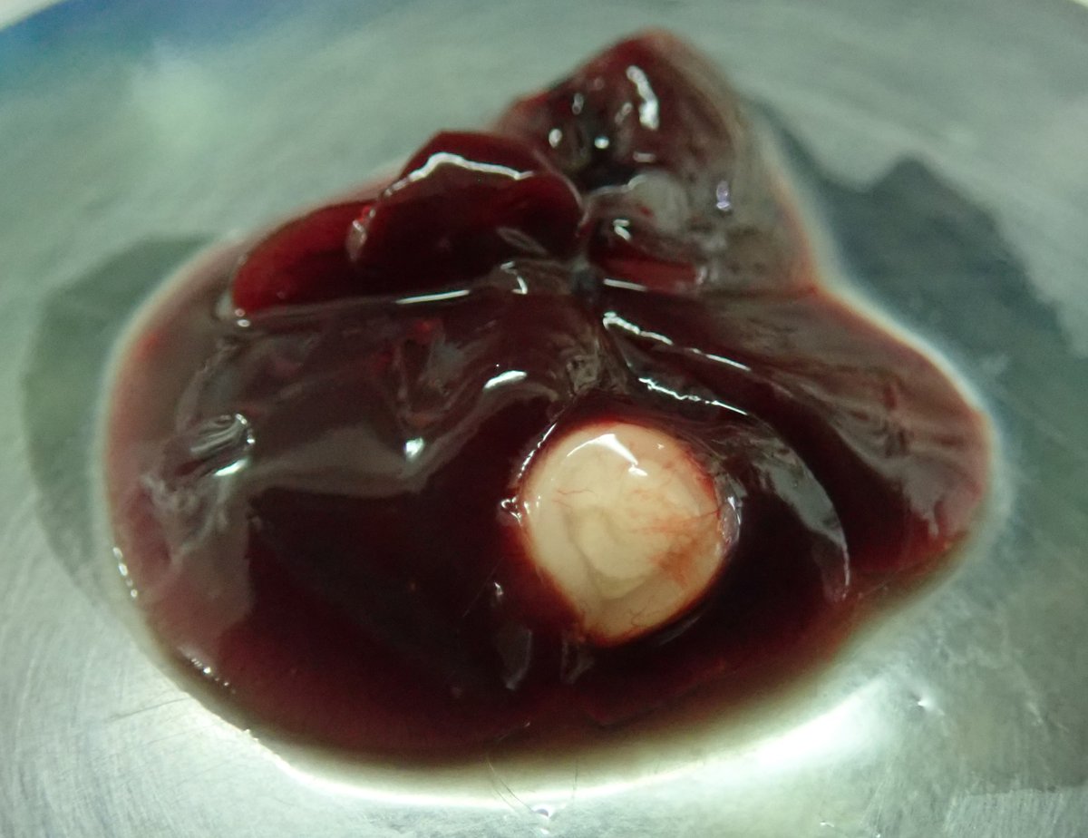 旭川医大寄生虫学講座 そうそう ネコといえば これ 猫条虫の幼虫 ネズミの肝臓 この白くて丸いところさ 気になるじゃん 薄皮破いて中身見たくならない 見たいんでしょー しょーがないなー リプ欄に続く