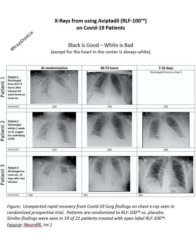UncleGeeGee's tweet photo. “There is currently no FDA-approved drug that has shown efficacy in patients who are already in the Intensive Care Unit (ICU) with Respiratory Failure.”

#AviptadilStopsCovid 

#COVID19 #RLF100 #XraysDontLie
https://t.co/cWJXk7QJo6 https://t.co/gdV6188sLC