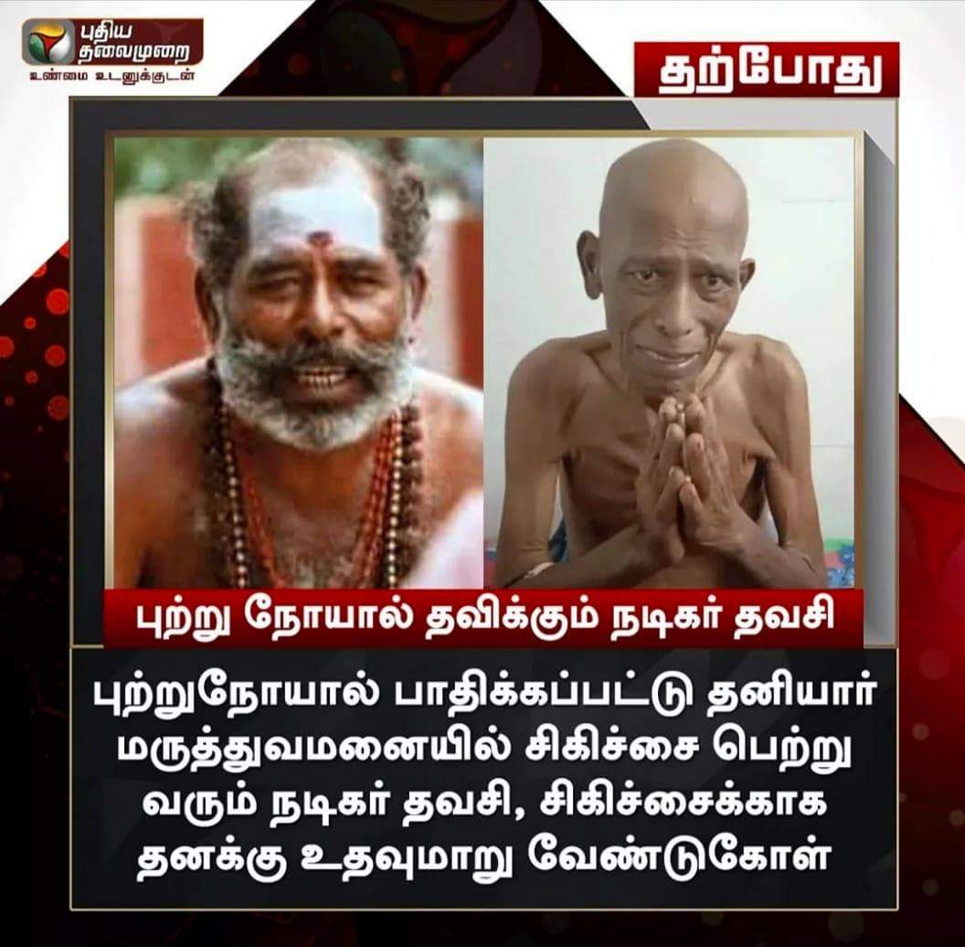 vigneshtweetzz's tweet photo. @Karthi_Offl  @Suriya_offl @Hari_AISFC Anna Plzz Thavasi ki Help pannunga 

Guyz Suriya annata Reach agura varaikum Retweet panunga #thavasi  #Needforhelp #Help #HelpThavasi https://t.co/o6e3olnpu8