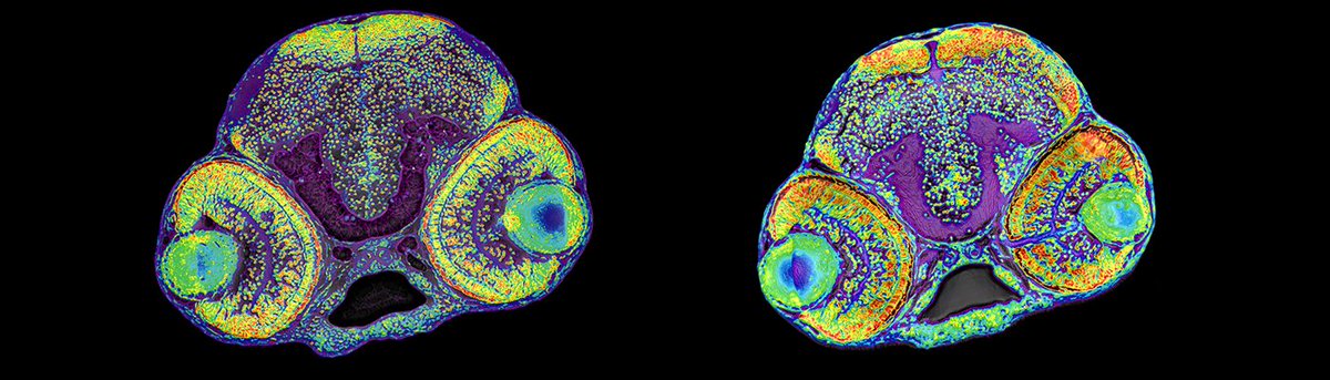 International research headed by Danish Scientists at University of Copenhagen has led to the discovery of a new mechanism that controls the size of our brains. Read more www1.bio.ku.dk/nyheder/nyhede… #cellbiology #molecularbiology #lundbeckfonden @t_soren @LarsAllanLarsen