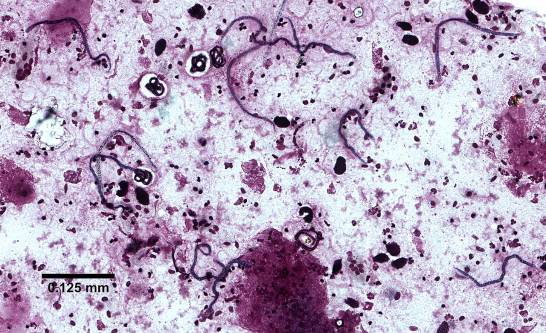 empcierto's tweet photo. Un estudio advierte de las posibilidades de que nuevos nemátodos infecten a humanos https://t.co/MOd7buJto9 https://t.co/490VpVV0KD