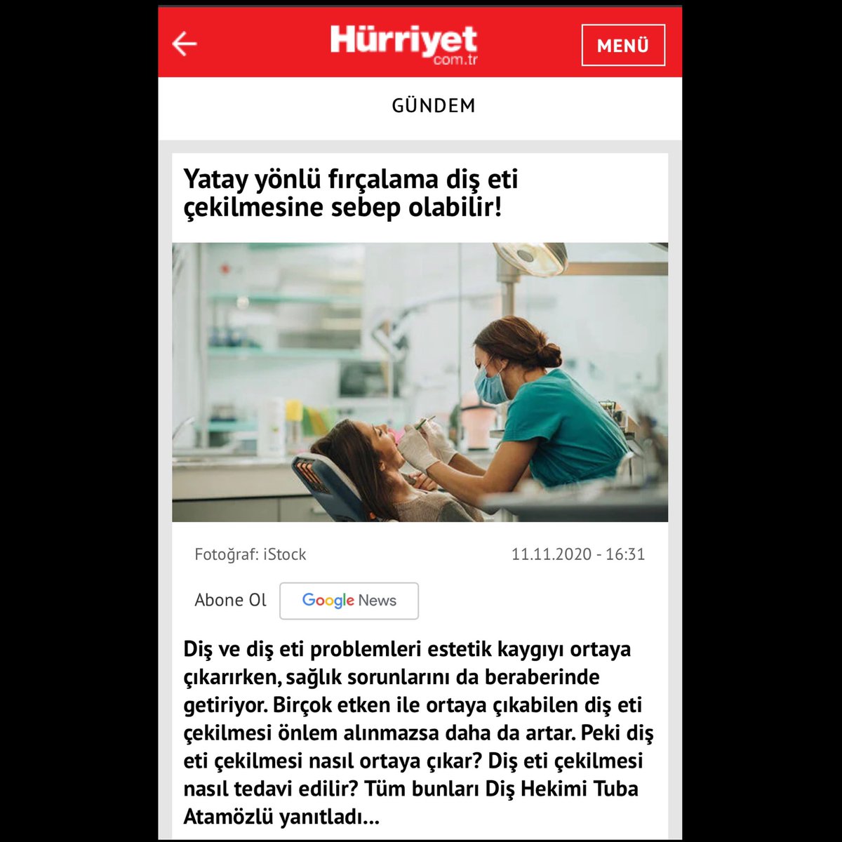 Diş eti çekilmesi özellikle ileri yaşlarda bir çok kişinin karşılaştığı bir problemler. Nedir ? Önlemleri nelerdir? Nasıl tedavi edilir ? 

google.com.tr/amp/s/www.hurr…