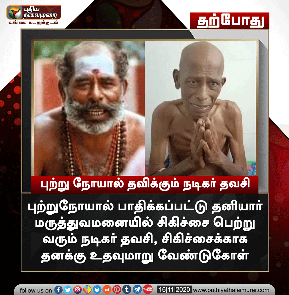 ptspotlightbe's tweet photo. ‘சிகிச்சைக்காக உதவுங்கள்’ - நடிகர் தவசி வேண்டுகோள்

#Thavasi | #ActorThavasi | #Cancer https://t.co/swrg2BZfj1
