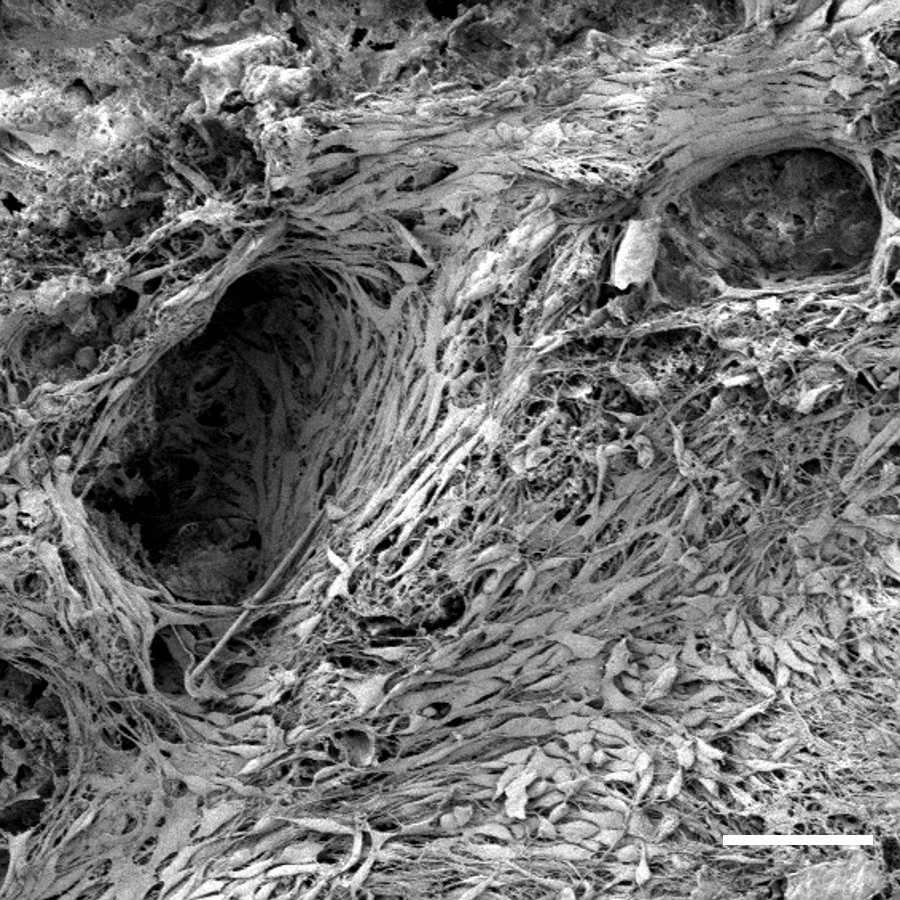 pellinglab's tweet photo. 2/ We speculated that the porous bread crumb might be a nice 3D scaffold for cells (scale bar = 1mm). It took some tinkering but a soda bread recipe seemed to support fibroblasts as seen in this SEM image (scale bar = 100um) ππ§«π¬ #biomaterials #breadbased #frugalscience https://t.co/YUp4ltEnu5