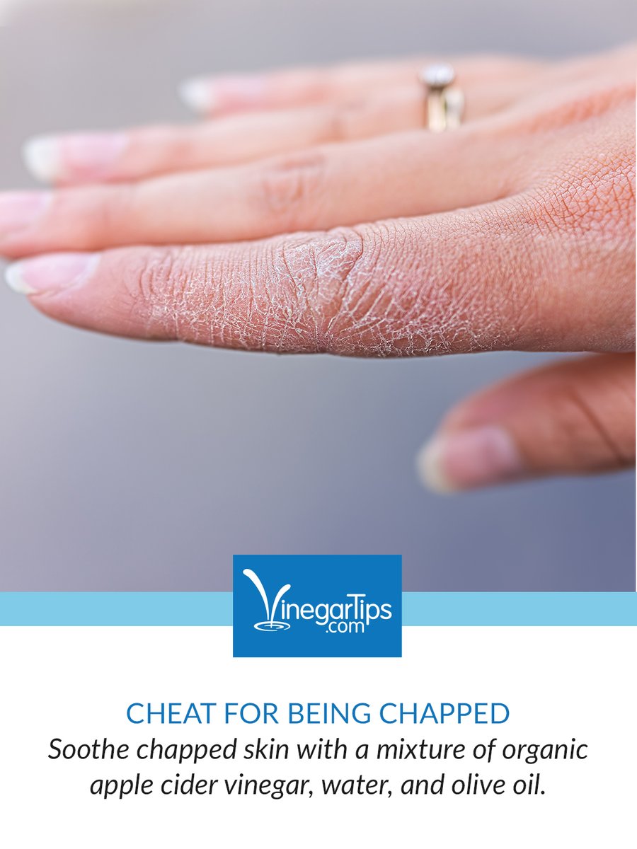 VinegarTips's tweet photo. Colder outdoor temps and dryer air inside + extra hand washing to avoid germs leads to dry, chapped hands. We've got just the solution to combat winter skin woes.👏  https://t.co/WOgO1XEk0U https://t.co/zq2e3OfHTQ