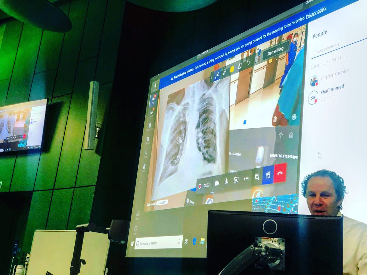 ShafiAhmed5's tweet photo. The first mixed reality surgical ward round teaching @QMULBartsTheLon. 70 medical students social distanced in the lecture theatre - taught on surgical cases @RoyalLondonHosp  @NHSBartsHealth. This is the future of medical education. @HoloLens @MSEducationUK #MedEd @profcknowles https://t.co/68iVFifZPj