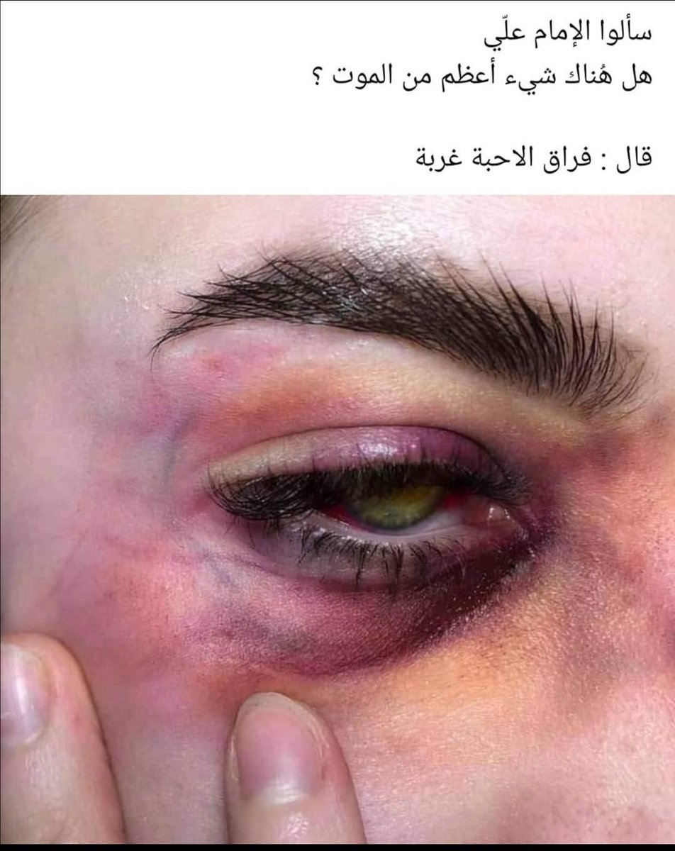 Randakh09's tweet photo. #خريجي_صحه_تناشد_الكاظمي https://t.co/N924KeJp2G
