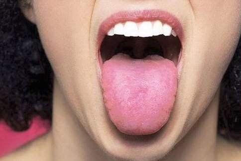 liping_mtc's tweet photo. La lengua refleja el estado de todos los #zangfu.
Se divide en regiones, cada una de las cuales pertenece a un órgano particular, indicando el estado del mismo. Ej: la punta pertenece al Corazón, por lo que una alteración en esa área de la lengua... - https://t.co/GWQPHbcxyt https://t.co/iYS5V6dNXv