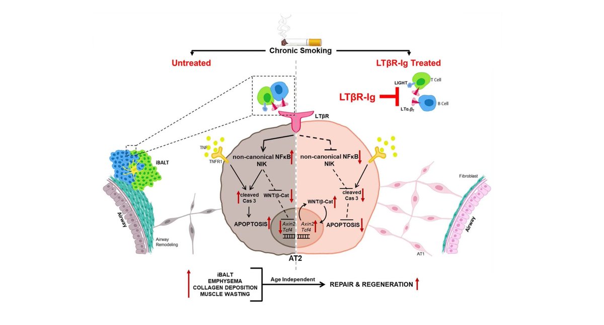organoidscience's tweet photo. 👨‍⚕️ Drs. Ali Önder Yildirim (@AlionderCPC) and Mathias Heikenwälder (@CancerInflam) demonstrated increased expression of LTβR ligands in adaptive and innate immune cells from patients with smoking-associated #COPD. #organoids

New in @nature | https://t.co/iMx8qIgHUI https://t.co/dnkPuKSxxX