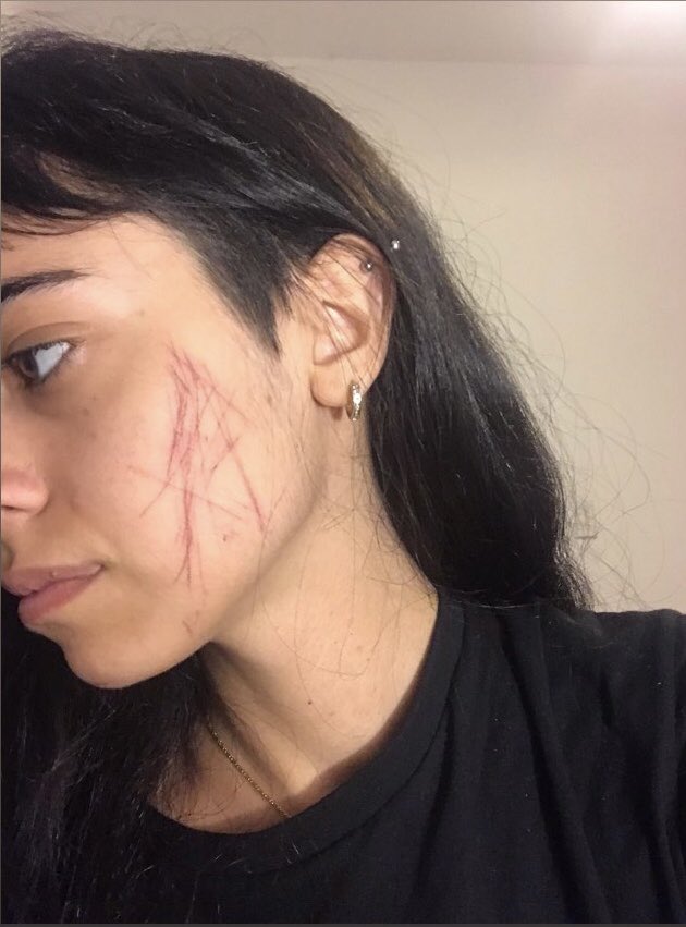 marubertona's tweet photo. Si no nos cuidamos entre nosotras, quien? No me alcanza ni la bronca para expresar lo que siento https://t.co/9HekbPMvd4