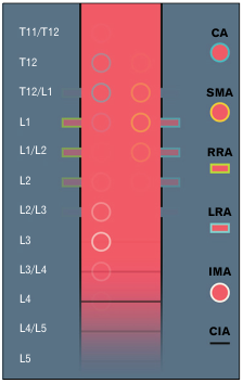AcbjournalO's tweet photo. Variation in the vertebral levels of the origins of the abdominal aorta branches: a retrospective imaging study

https://t.co/J6ME5dZYqd
Anat Cell Biol 2020; 53(3): 279-283

#대한해부학회 #AnatomyCellBiology 
#ComputedTomographyAngiography #AbdominalAorta #AnatomicVariation https://t.co/e9YhkztrQN