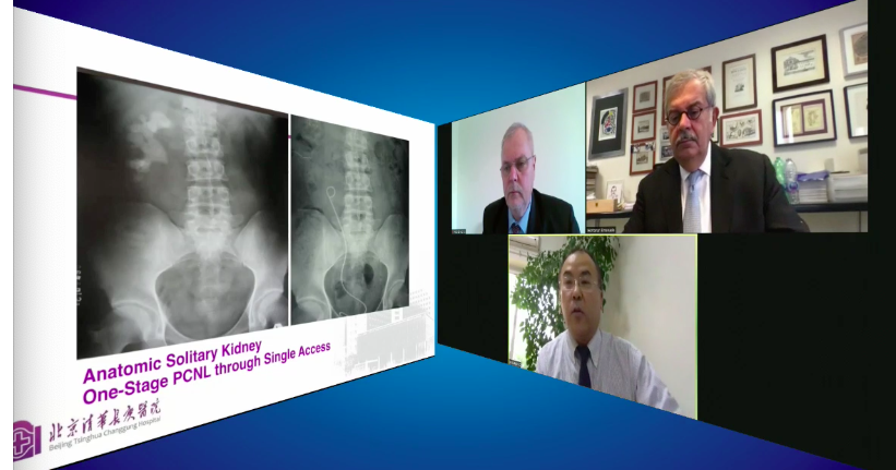 Esteban_Acuna_G's tweet photo. Starting 2nd Day #WebCongressTnT2020 #XRayFree #Pcnl by @jianxingli_CN Moderators @HoznekAndras @emanuelemontan3 #TnTEndoUro2020 https://t.co/GdyxrKvb3T