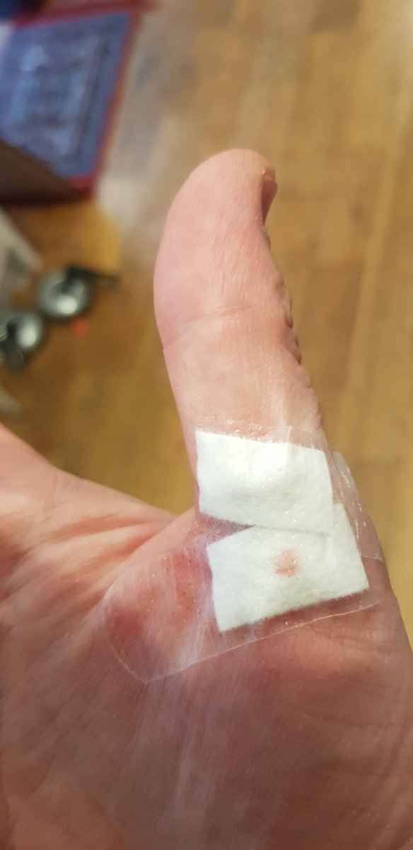 PabloBonzo's tweet image. In other none Presidential or Covid-19 related news. Apple Segmenters are evil. Going to make a day of near constant hand sanitising all the more fun. #HowDoYouLikeThemApples #CutToTheCore