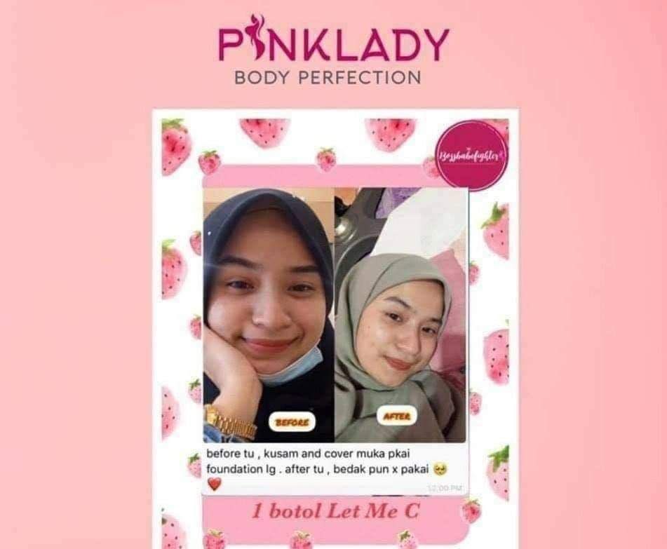 YuniePinkLadyHQ's tweet photo. Best x best #LetMeC ni...😍
.
Giler x best Kemam2 je gebu kulit
.
Selamat... 1 0 0 %...
.
Xyah dah drip #vitamin sebab nak putih..
.
Kemam je pun boleh putih bersih tanpa cela. 😘😘
📲 https://t.co/p9sYQ5HeUq
#letmec #letmepl #letmecpinklady https://t.co/BIoF5Fy7VF