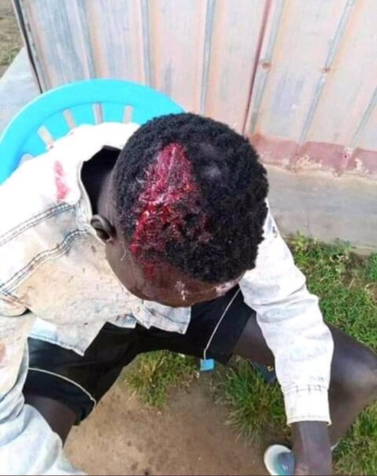 kwagala_'s tweet photo. They may slow us down but they can't stop us. Giving up is not an option to me. We raise our voices till we are heard.
#StopPolicebruitalityinUganda https://t.co/r8jPBSewNN