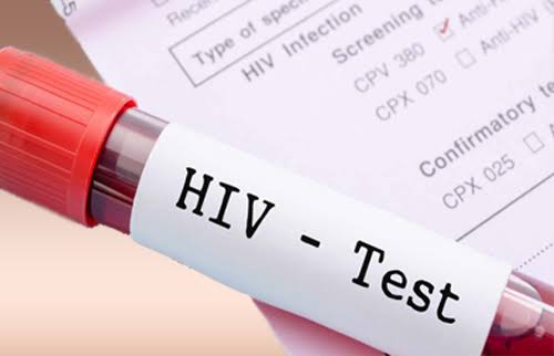 PLHIVResponse's tweet photo. HIV testing is essential for slowing the spread of HIV infection. Many people are unaware that they're infected with HIV , so they may be less likely to take precautions to help prevent spreading the virus to others.
testing for HIV is the only way to know if you have the virus. https://t.co/gPKOHzjoBR