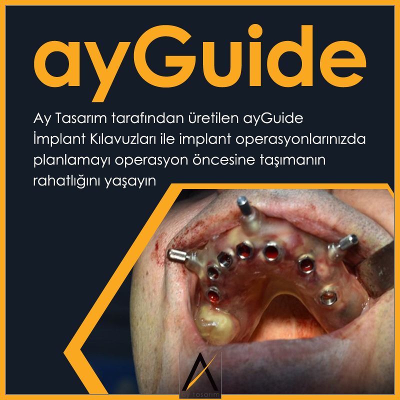 aytasarim's tweet photo. Ay Tasarım tarafından üretilen ayGuide İmplant Kılavuzları ile implant operasyonlarınızda, planlamayı operasyon öncesine taşımanın rahatlığını yaşayın.⠀⠀
#DigitalDentistry #ayGuide #Guide #Stent #Plak #GuidedSurgery #ComputerGuidedSurgery #DikissizCerrahi https://t.co/7kwfOBBAqF