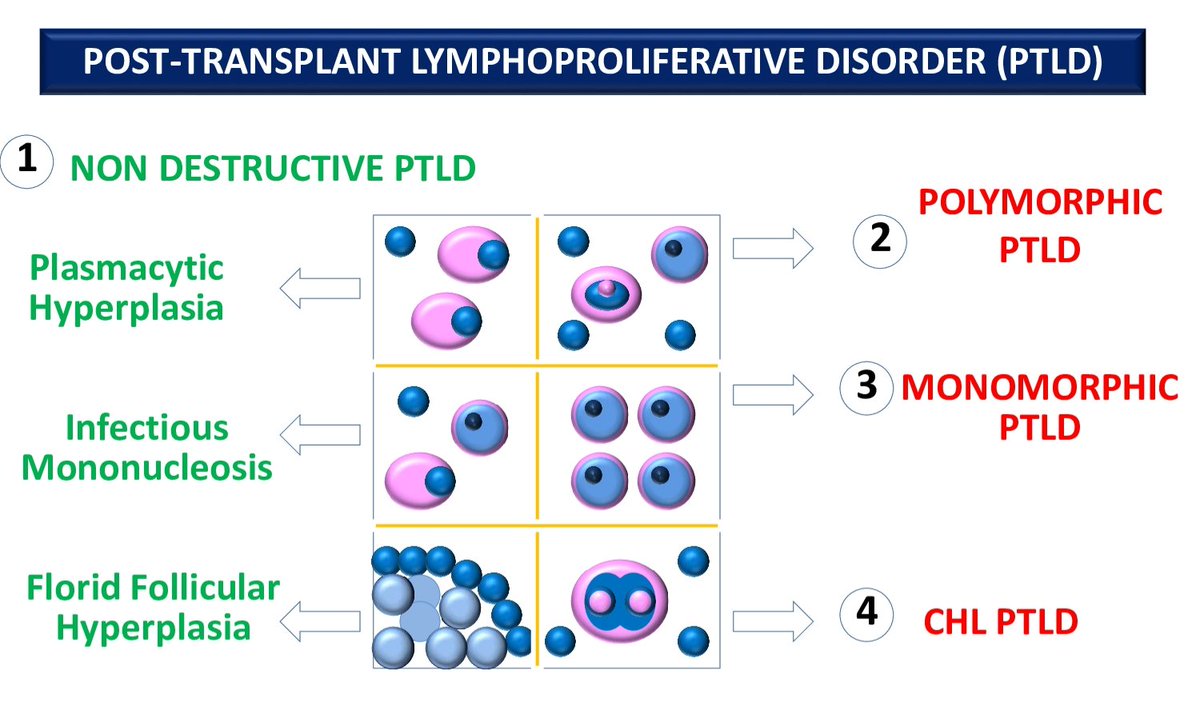 AbhijitSurgPath's tweet photo. Post-transplant Lymphoproliferative Disorder (PTLD)
4 important groups:
Non destructive PTLD
Polymorphic PTLD
Monomorphic PTLD
Classic Hodgkin Lymphoma PTLD
Basic facts for residents
#MakeSurgiPathEasy
#PTLD
#Hematolymphoid https://t.co/FLDSC9Y9qF