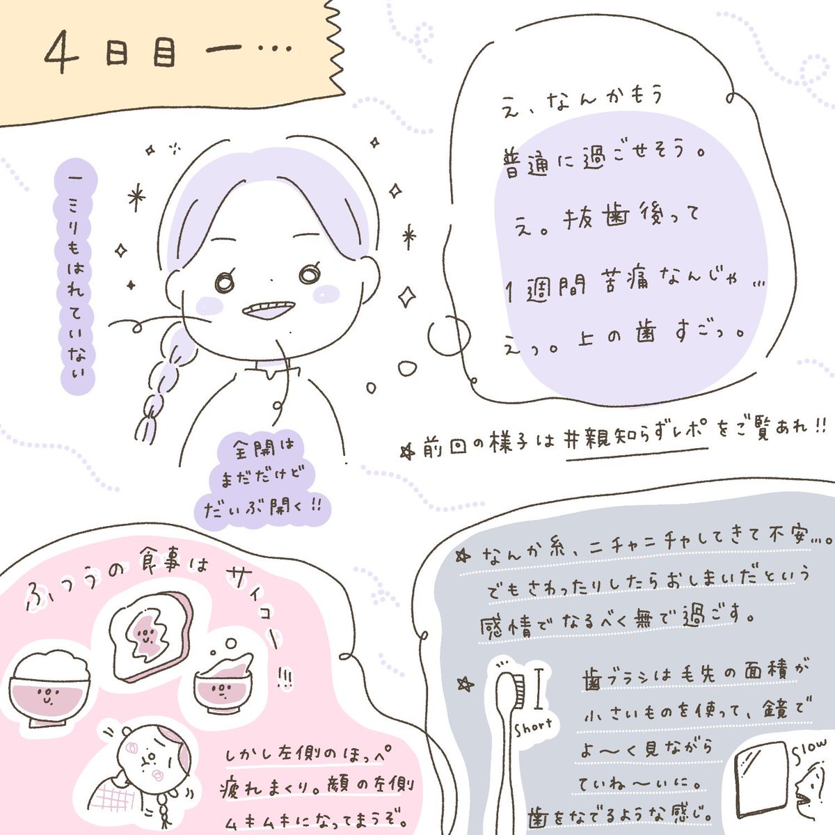 ? 親知らず抜歯レポ ② ?

2〜4日目の様子です。右上抜いたんだけど、左ばかりで噛むもんだから左のほっぺムキムキになってまうぞ?と不安になりました。 