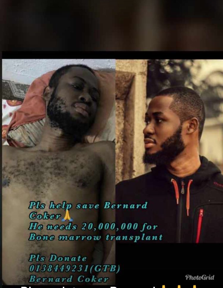 anastasiauntamd's tweet photo. @aproko_doctor @Yodaddy8624 @aproko_doctor pls help save bernard. This is what Nigeria did to him https://t.co/jdJG676a8w
