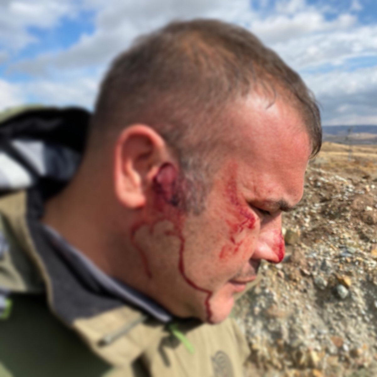 Kırıkkale İl Şube Müdürlüğü personelimiz Hakan Tonga, kaçak avcılıkla mücadele ettiği esnada, kaçak av yapan 5 kişi tarafından darp edilmiştir. Personelimiz Hakan Tonga'ya geçmiş olsun dileklerimizi iletiyoruz.

Bu saldırıyı gerçekleştirenler hakkında hukuki süreç başlatılmıştır.