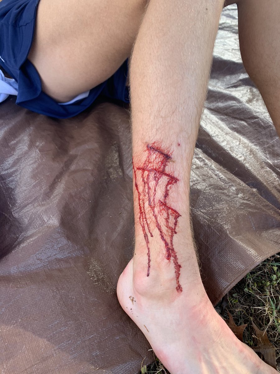 Congrats to Brent who completed and finished strong in the State Meet despite being tripped and spiked! <a href="/wcsCHSAthletics/">Centennial Athletics</a> <a href="/wcsCHS/">CentennialHighSchool</a> <a href="/CHSCAC/">Cougar Athletic Club</a>