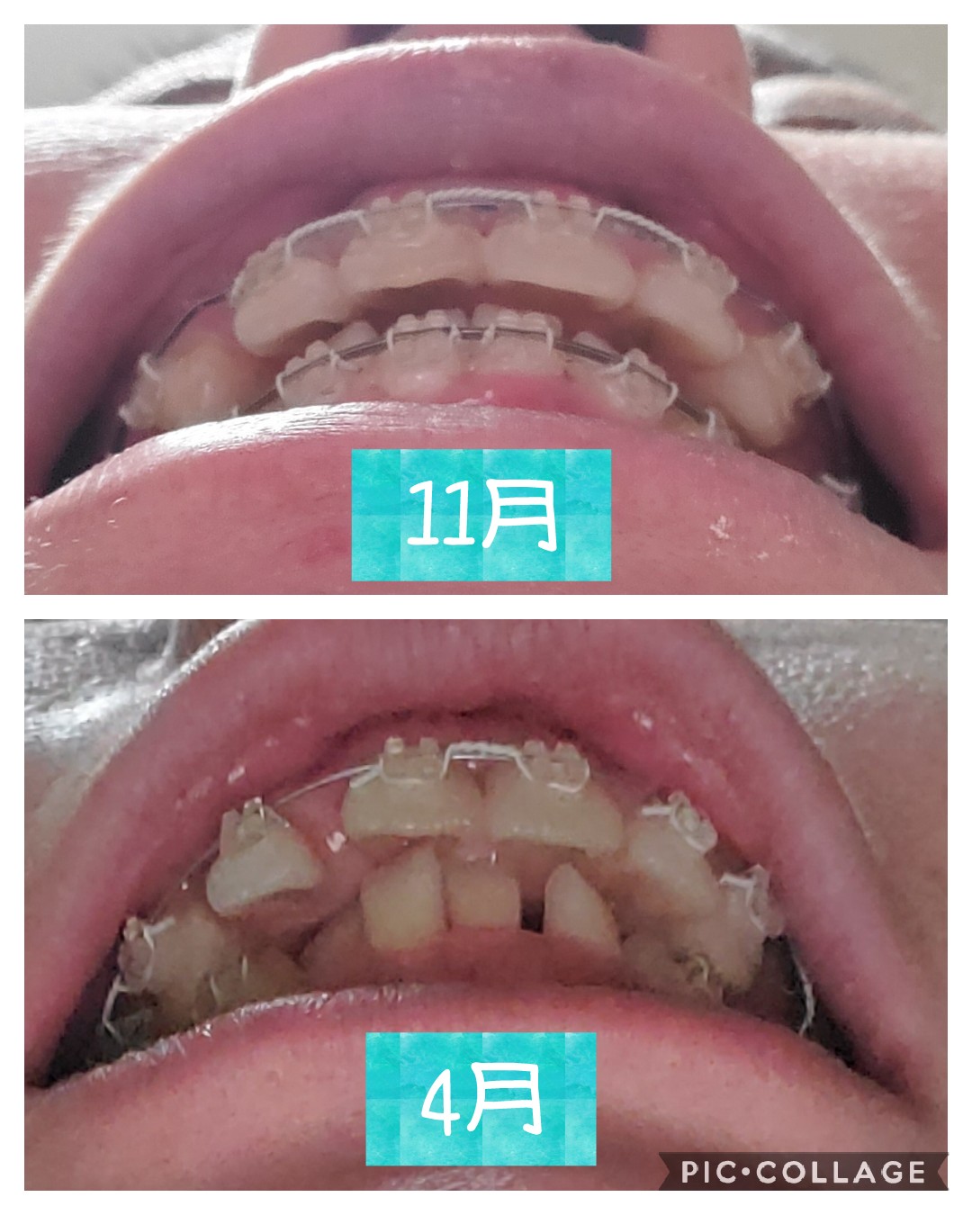 のねずみく 凄い前歯の通販 はむこ7423 S Shop ラクマ By カテゴリ