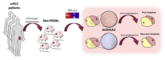 EmboMolMed's tweet photo. Extensive series of #RCC biopsy‐derived #PDOX reveal patient‐specific induction of #metastasis after #antiangiogenics.
Pre-treatment ALDH1A3 predicts response to therapy.
By O. Casanovas and colleagues @idibell_cat
Read #openaccess: https://t.co/0WK2o5WguP https://t.co/Xfu3ltY6Qj