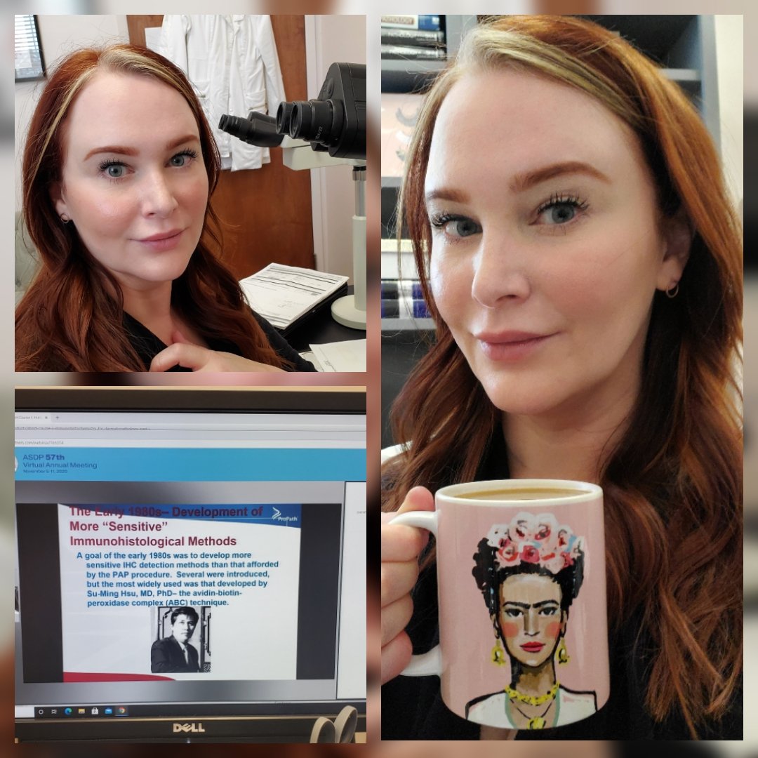 DrSarahDerm's tweet photo. We're baaack! ASDP annual meeting is fully virtual this year. Enjoying Short Course I from the comfort of my office. #ASDP20 #ASDP2020 #ASDPTweets @ASDPTweets @JMGardnerMD #dermpath #dermatopathology https://t.co/XEOYY48DQc