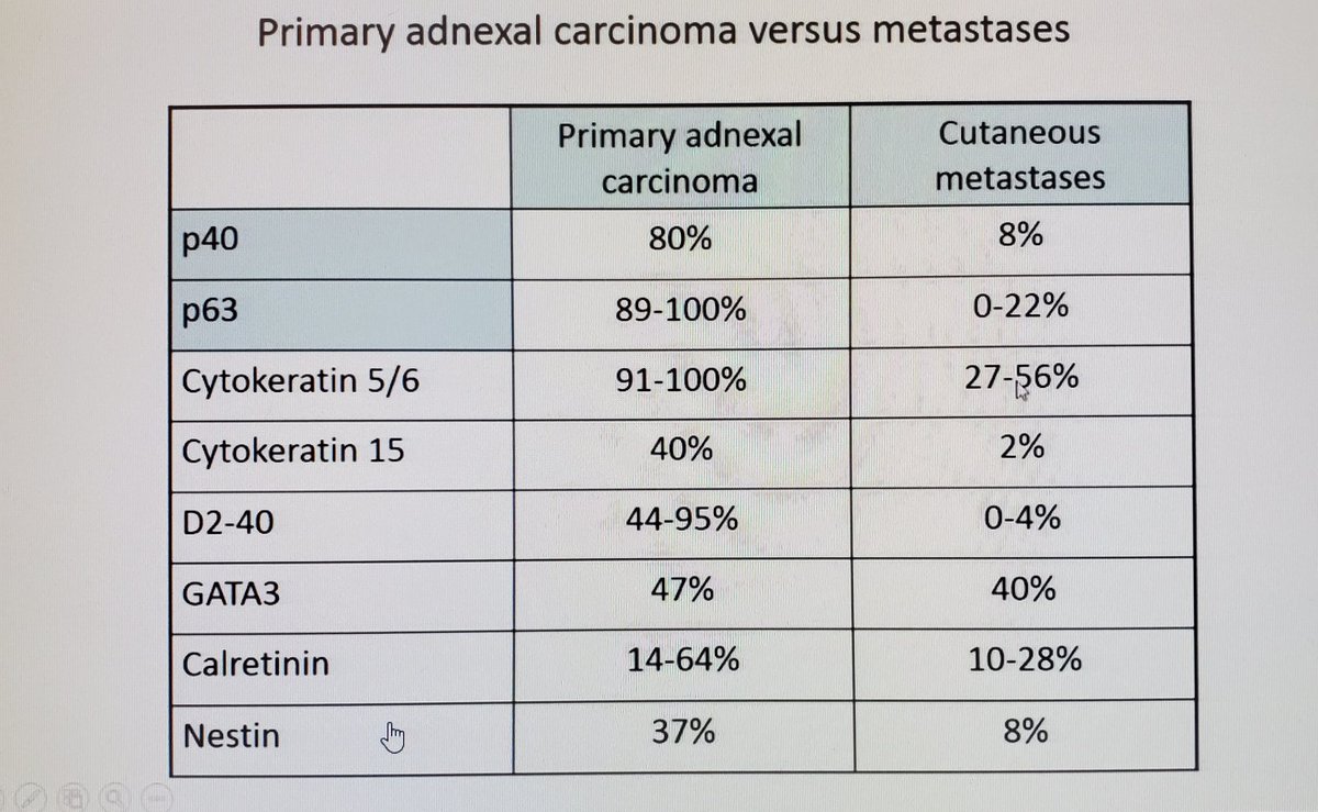 DrSarahDerm's tweet image. p40 and P63 are reasonable markers to help determine primary adnexal CA from mets. P63 is more sensitive in primary skin CA, but p40 is more specific. #ASDP20 #asdp2020 #skincancer #metastasis @ASDPTweets