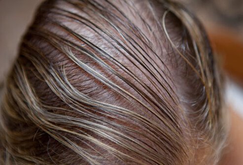 Thin hair affects millions of Americans.  National Hair Centers has several options to treat and prevent signs of hair loss.  Our consultations are always free!
