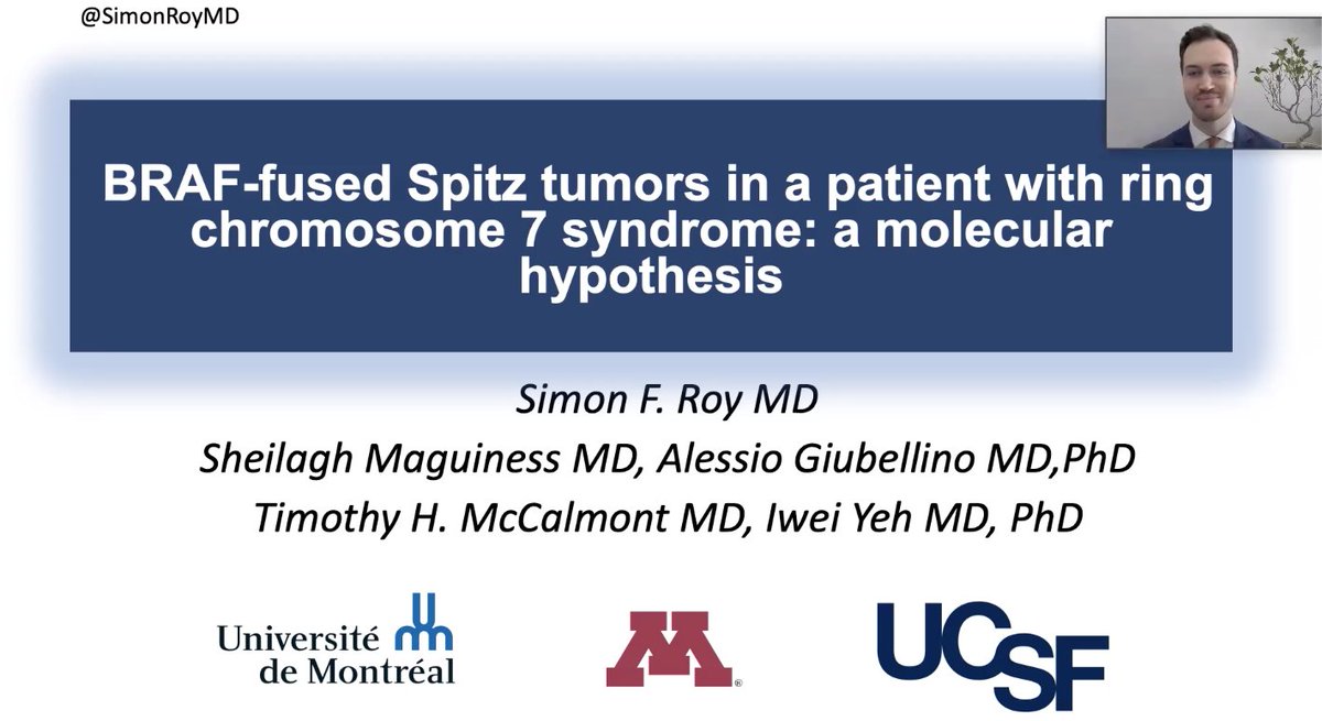 SimonRoyMD's tweet image. If you're at #ASDP2020, feel free to check out our Duel presentation about BRAF-fused Spitz tumors in a patient with ring chromosome 7 syndrome. Video accessible anytime during!