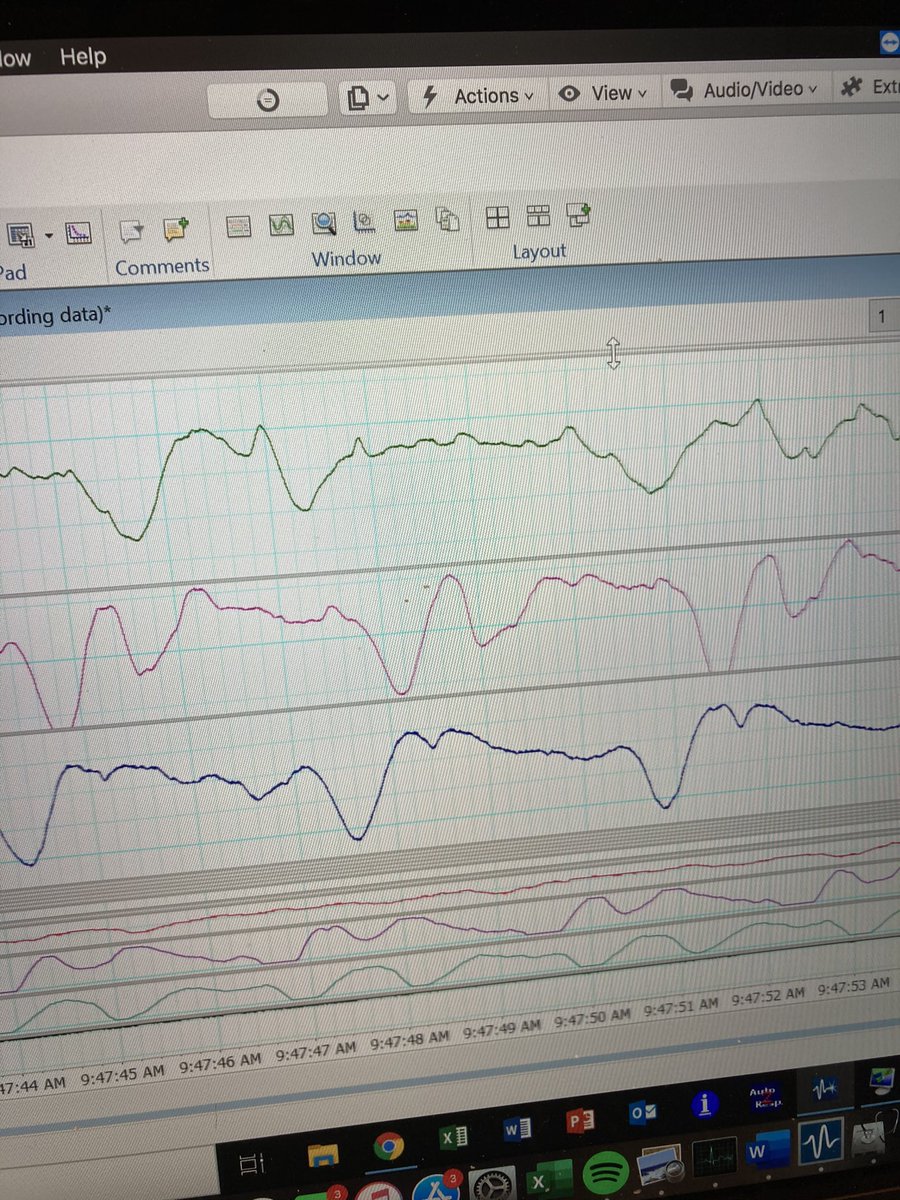 sarahnanco's tweet photo. I have a love-hate relationship with getting heart rate data in mussels. I hate setting the system up but I love seeing the heart rates in real time! These bad boys are currently in day 2 of a heat wave simulation and are going strong! #teammussel https://t.co/sInucGQkeO
