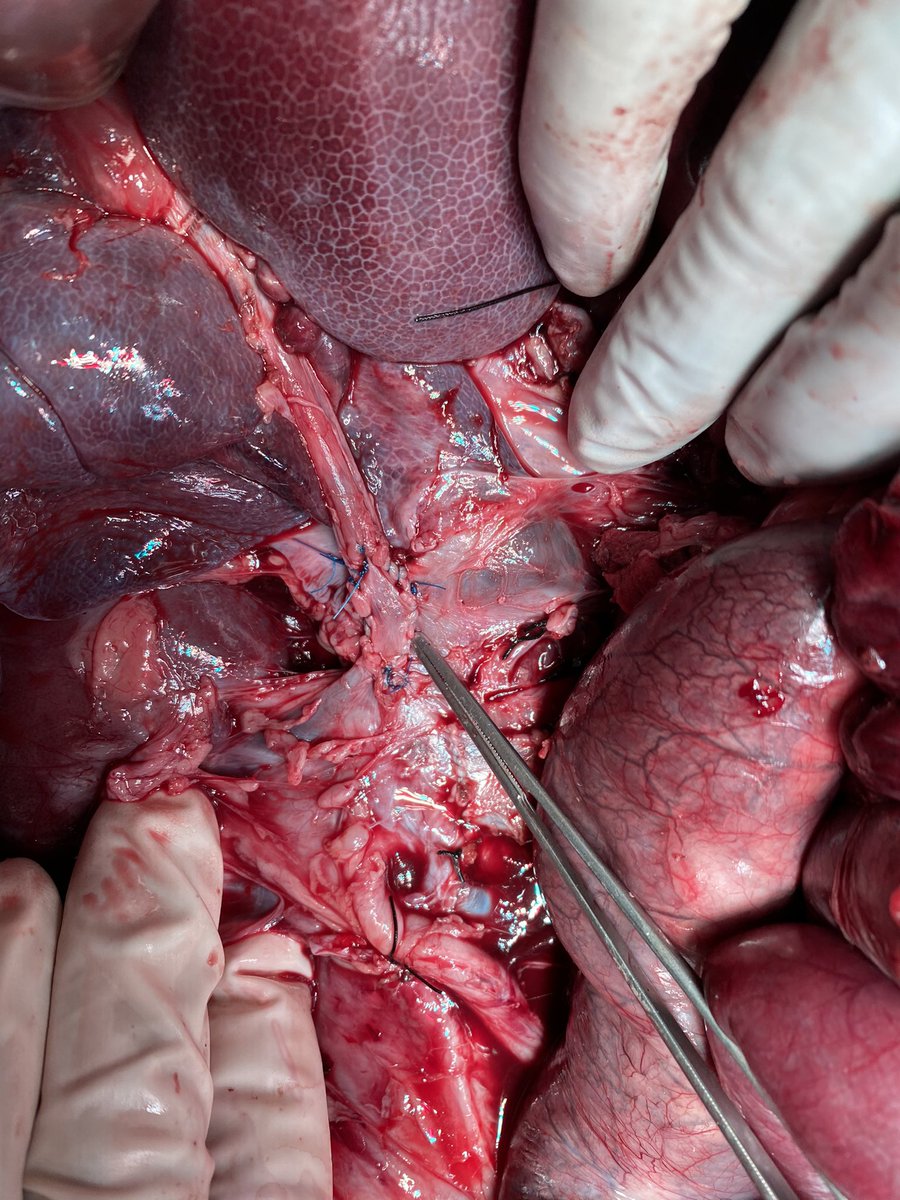 pmuriel_al's tweet photo. Después del magnífico webinar de resección vascular del Dr. Emilio Vicente en @IHPBA y @aecirujanos el staff joven de @Hbp_EgLleida ha querido ponerlo en práctica gracias a nuestro centro @creballeida
#surgicaltraining @seccionhbpaec @MikelPrieto4 @JjOlsina @aecformacion @MIAGB2 https://t.co/Fm5FYu1KKp